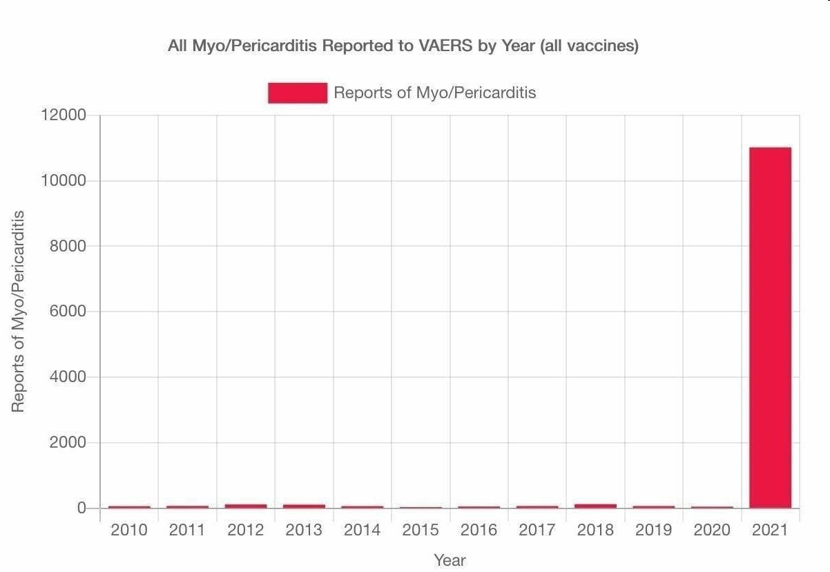 myocarditis